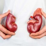 پیشگیری از بیماری‌های کلیوی با چکاپ منظم