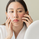 چگونه از پوست خود در برابر تغییرات هورمونی محافظت کنیم؟