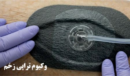 وکیوم تراپی زخم عفونی وکیوم تراپی زخم عفونی