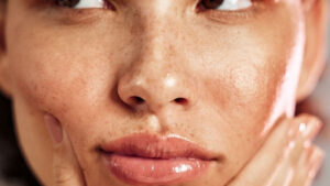 بهترین روش چاقی صورت + راهکارهای تضمینی و کاربردی