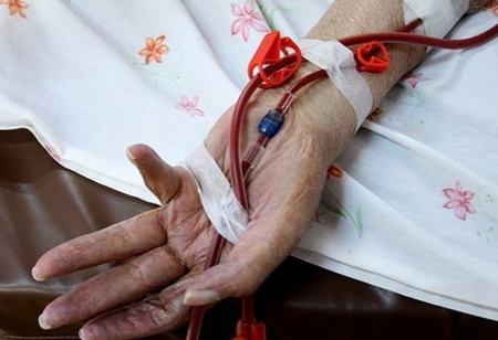 بیماری هموفیلی،اخبار پزشکی،خبرهای پزشکی بیماری هموفیلی،اخبار پزشکی،خبرهای پزشکی