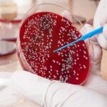 افزایش نگران‌کننده سرطان روده بزرگ در ایران