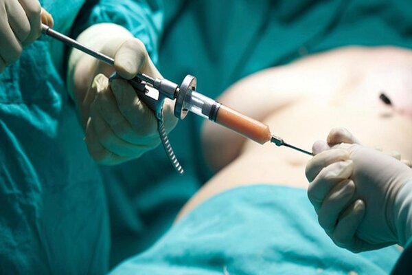 جراحی چاقی آخرین راه است یا اولین انتخاب؟ جراحی چاقی آخرین راه است یا اولین انتخاب؟