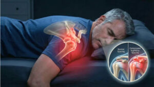 درد شانه در شب یک علت پنهان دارد که پزشکان در مورد آن هشدار می‌دهند