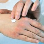 راهکارهای طب ایرانی برای حفظ سلامت پوست و بدن در فصل سرد