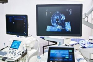 علائم هشداردهنده سرطان‌های زنان را نباید نادیده گرفت