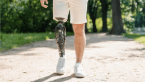 پروتز پا؛ از چوب قدیمی تا ربات‌هایی که مثل پای واقعی راه می‌روند!