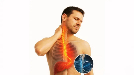 کبد چرب و درد گردن: ارتباطی که زندگی هزاران نفر را تغییر داد