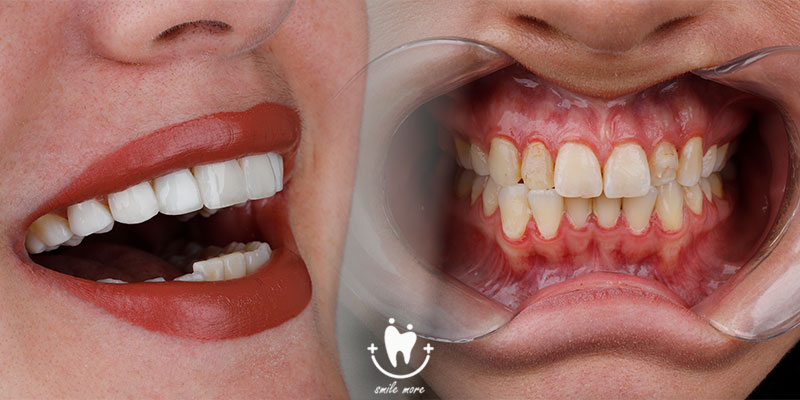 بهترین دکتر کامپوزیت در تهران