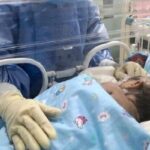 آب حاوی فلوراید، بر وزن هنگام تولد تأثیری ندارد