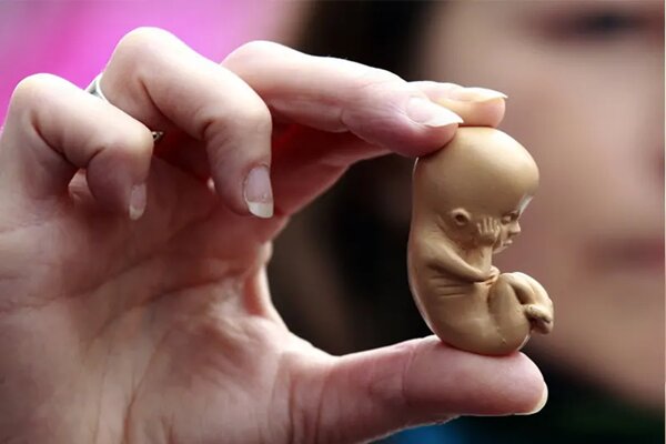 الکل در بارداری؛ خطری که با هیچ درمانی جبران نمیشود الکل در بارداری؛ خطری که با هیچ درمانی جبران نمیشود