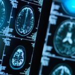 هشدار به بیماران صرعی و آسمی درباره قطع دارو در ایام روزه‌داری