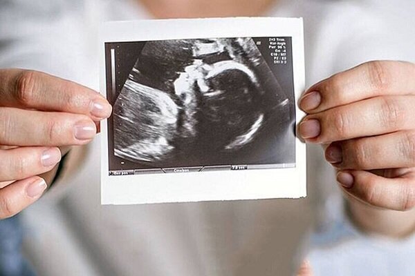 همه‌چیز درباره IVF؛ شانس موفقیت، هزینه‌ها و واقعیت‌ها