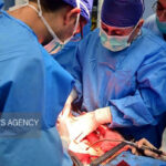 چه کسانی بیشتر در معرض خطر تومورهای مغزی هستند