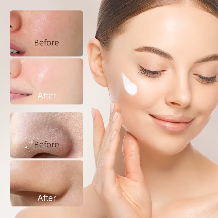 کرم ضد پیری