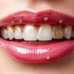 لبخندت کپی بقیه است؟ تفاوت نگین دندان و گریلز؛ انتخابی برای اتمسفر جدید تو!