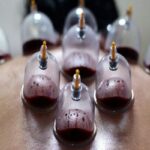 حجامت توسط افراد غیر متخصص خطرناک است