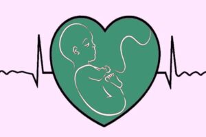 رفلاکس بارداری؛ از فشار رحم تا تغییرات هورمونی