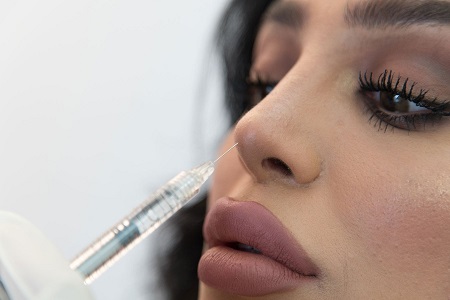 تزریق ژل به بینی روشی بی خطر و کم هزینه برای اصلاح فرم بینی