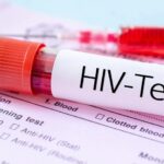 مهم‌ترین چالش امروز HIV در ایران