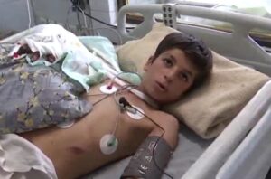 یک جراحی کم‌نظیر در بروجرد؛ دست قطع‌شده نوجوان دوباره به بدن بازگشت
