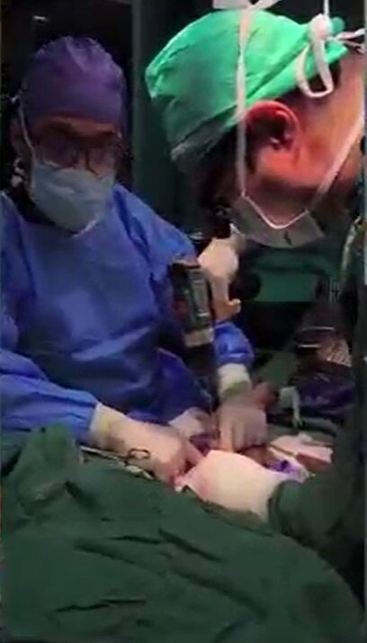 یک جراحی کم‌نظیر در بروجرد؛ دست قطع‌شده نوجوان دوباره به بدن بازگشت