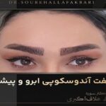 لیفت اندوسکوپیک ابرو و پیشانی