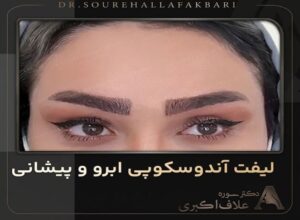 لیفت اندوسکوپیک ابرو و پیشانی
