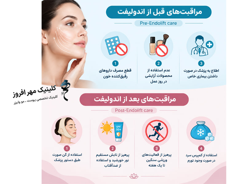 اندولیفت؛ جوانسازی و لیفت صورت بدون جراحی مراقبت های قبل و بعد از اندولیفت