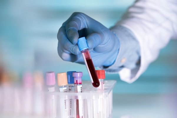 خطر HPV کاملا جدی است؛ نگرانی یک ویروس شناس